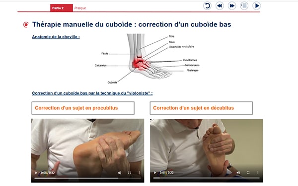 formation elearning cheville traumatique
