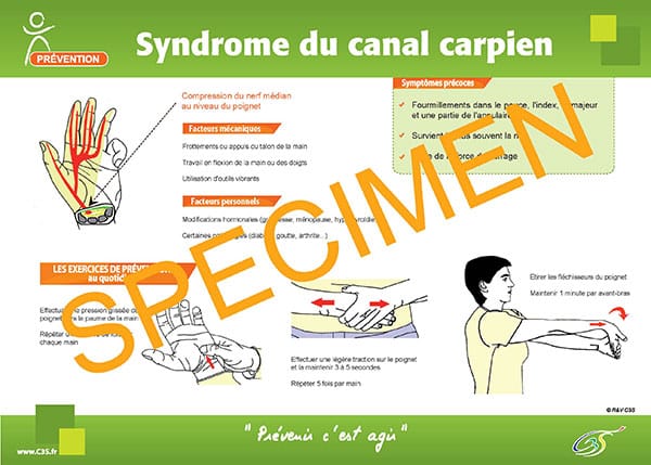 Le syndrome du Canal Carpien